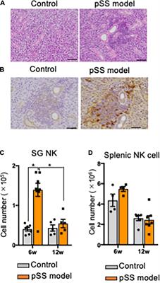 Disturbed natural killer cell homeostasis in the salivary gland enhances autoimmune pathology via IFN-γ in a mouse model of primary Sjögren’s syndrome